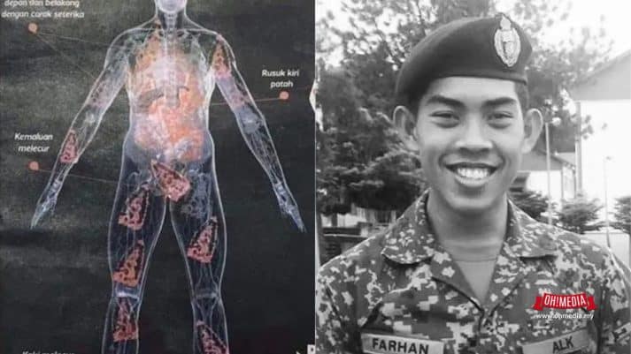 Ohmedia dr samhan | ohmedia zulfarhan osman 1 | oh Media | oh Media Ohmedia dr Samhan