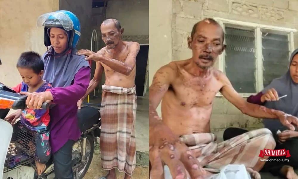 Ohmedia suami Sakit Kanser