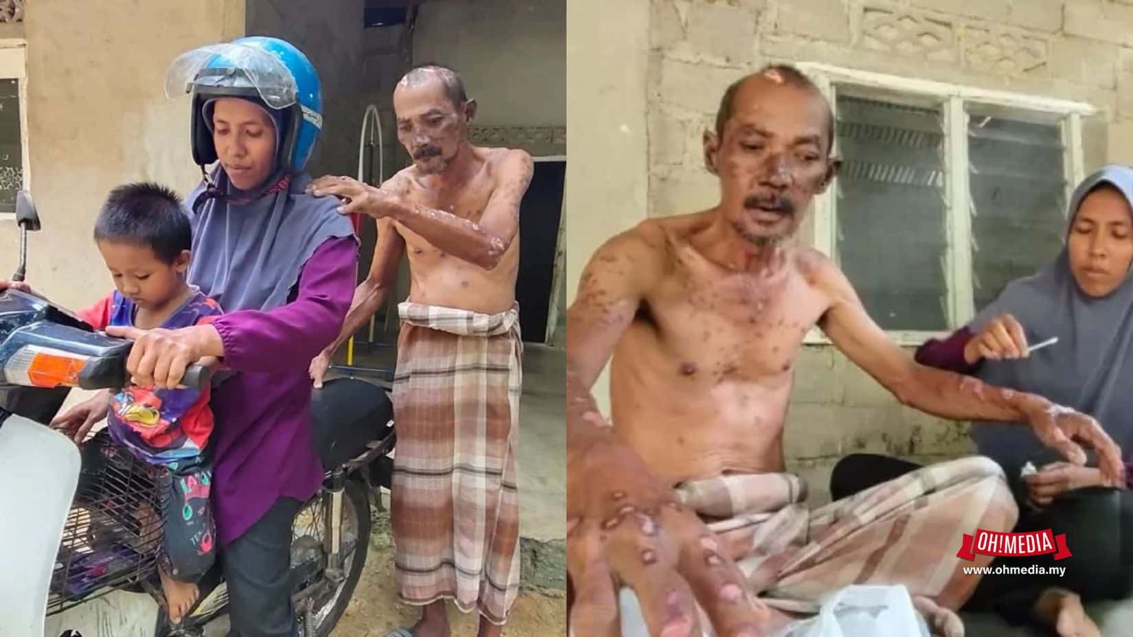 Ohmedia suami Sakit Kanser