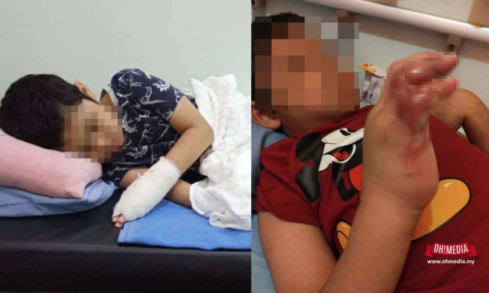 Ohmedia tangan cedera doktor cuai ohmedia | jururawat kata tak boleh buka ibu kecewa tangan anak cedera dibalut ketat | oh Tidak oh Media | oh Media Ohmedia tangan cedera doktor cuai ohmedia