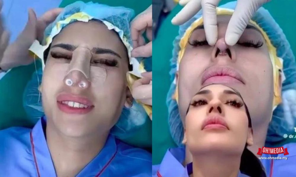 Zarina Anjoulie Minta Maaf Selepas Kongsi Video Pembedahan Hidung | Oh! Media