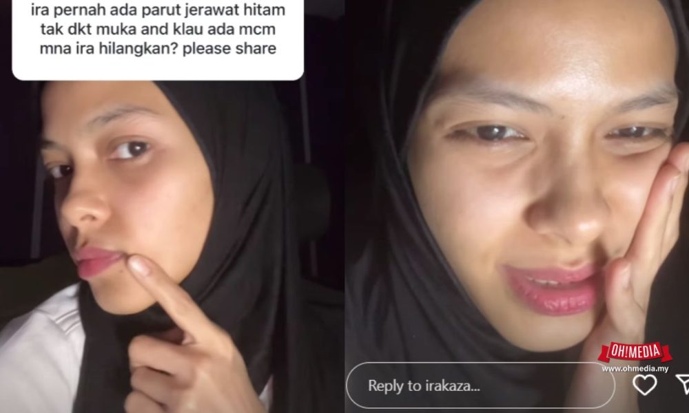 Ira Kazar Aktif Di IG Selepas Cerai, Kongsi Tips Kecantikan Muka | Oh! Media