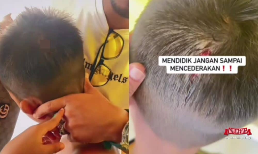 “Kalau Kena Mata Boleh Buta” – Guru Didakwa Baling Kotak Pensil Kena Kepala Murid | Oh! Media “Kalau Kena Mata Boleh Buta” – Guru Didakwa Baling Kotak Pensil Kena Kepala Murid | Oh! Media