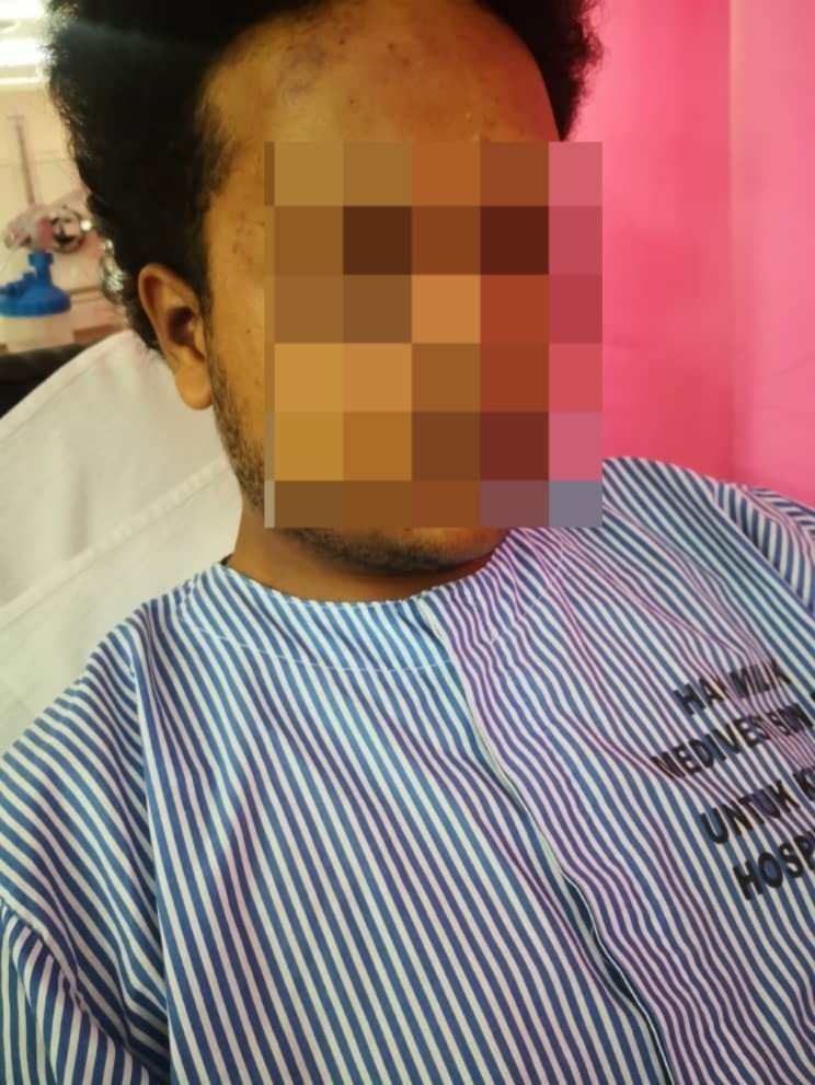 Lelaki Cedera Kena ‘Beduk’ Beramai-Ramai Gara-Gara Salah Info, 10 Suspek Ditahan Polis