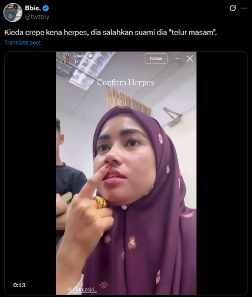 “Telur Dia Masam?” – Kieda Crepe Salahkan Suami Sampai Kena Herpes