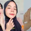 Suu Balm Vytle