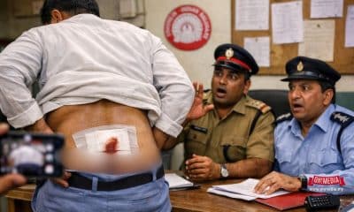 Ohmedia pekerja buasir india