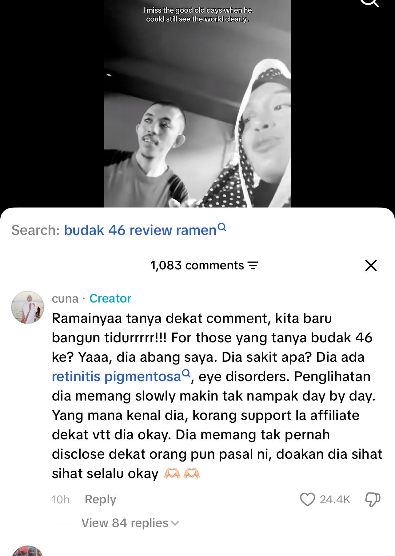 Telegram cloud size 5 6298797164720755880 w | mata makin tak nampak pernah viral dengan video slow mo budak 46 hidap retinitis pigmentosa | oh Media Telegram cloud size 5 6298797164720755880 w